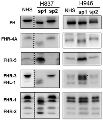 Complement Genetic Variants and FH Desialylation in S. pneumoniae-Haemolytic Uraemic Syndrome